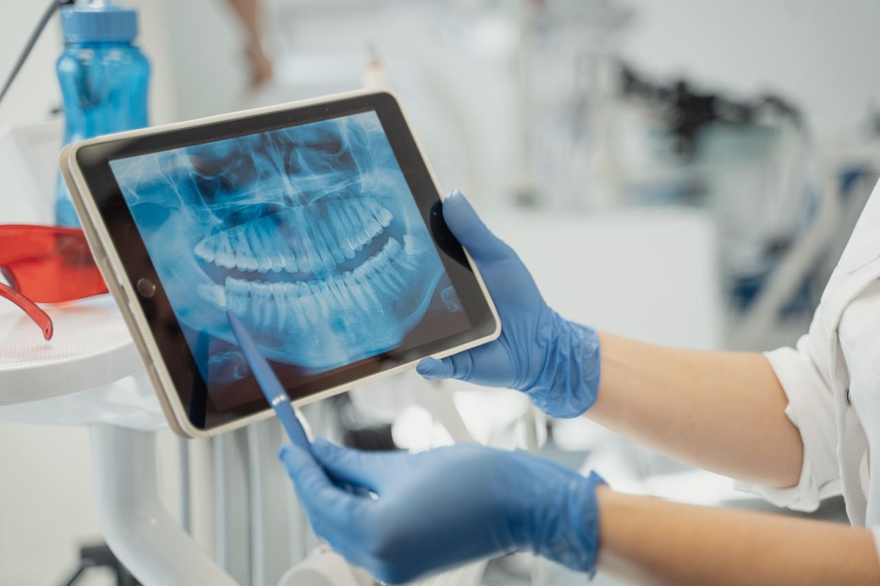 Mastering the First Impression: Your intriguing post title goes here Close-up of a dentist analyzing a dental X-ray on a digital tablet in a clinic setting.